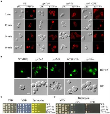 Loss of the putative Rab GTPase, Ypt7, impairs the virulence of Cryptococcus neoformans